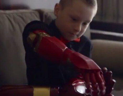 Prosthetics that could offer ‘sensation’ to amputees
