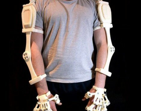 3D Printed Exoskeleton