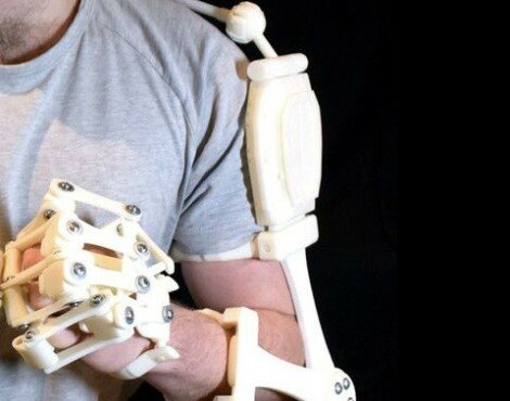 3D Printed Exoskeleton_2