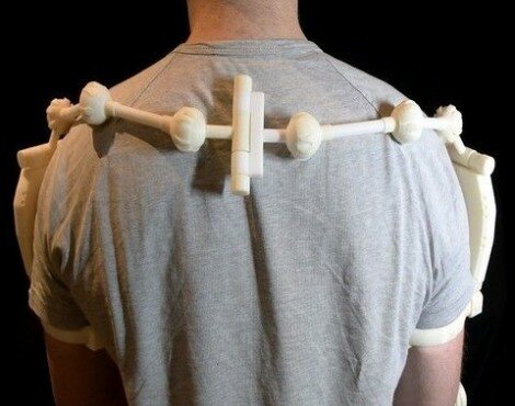 3D Printed Exoskeleton_4