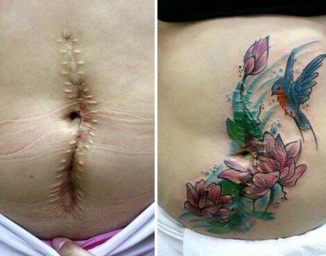 Artist Flavia Carvalho Transforms Domestic Violence Scars into Artistic Tattoos