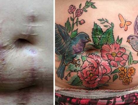Artist Flavia Carvalho Transforms Domestic Violence Scars into Artistic Tattoos